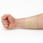 Burn Dressing Pads
