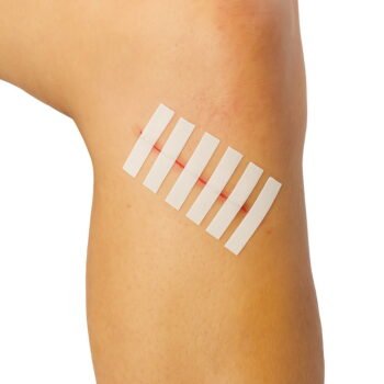 Wound Closure Strips